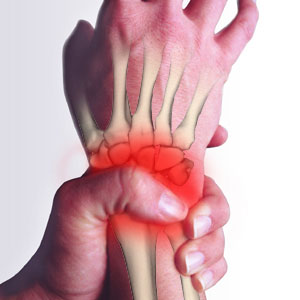 Wrist Pain Image